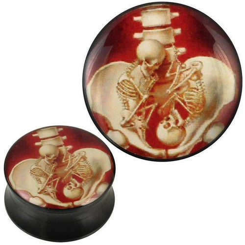 Plug Acryl Skelette schwanger Bauch Zwillinge schwarz Piercing Ohrschmuck